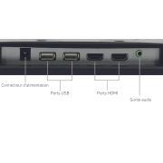 Moniteur Smart Android TV